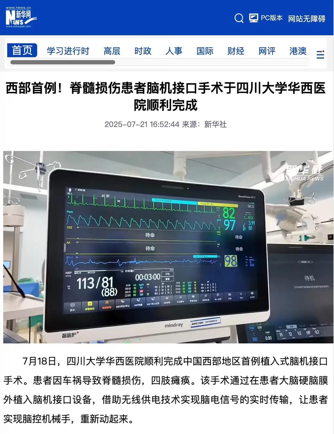 西部首例:四川大學華西醫院順利完成脊髓損傷患者腦機接口手術,可腦控機械手